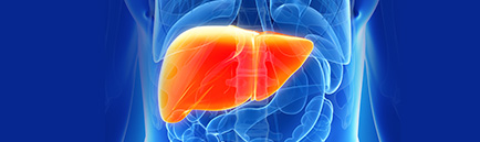 MSO 84 - Novo tratamento minimamente invasivo para câncer no fígado