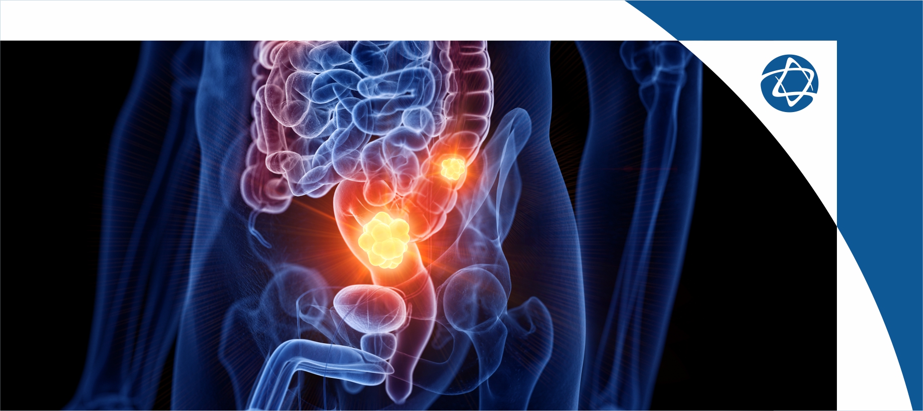 Centro de Oncologia e Hematologia Einstein realiza simpósio satélite no 70º Congresso Brasileiro de Coloproctologia