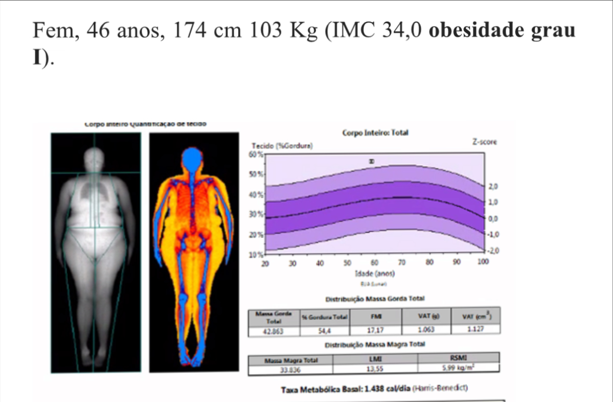 Densitometria óssea de corpo inteiro para avaliação de composição corporal (DXA)