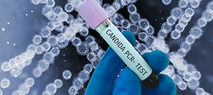 O PCR como aliado na detecção da Candida auris