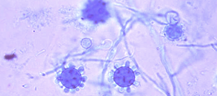 PCR para Histoplasma capsulatum agora é feito no Einstein