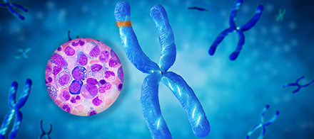 Exame molecular detecta mutações associadas à síndrome de VEXAS