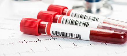 Testes genéticos em cardiologia: quando e por que fazer?